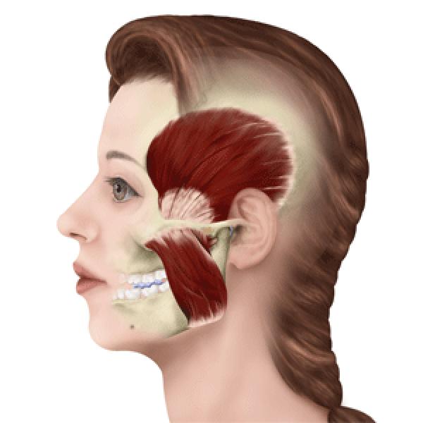 每日一肌大臂疼,牙疼咬肌肿了