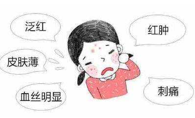 脸上有红血丝平时应该怎么护肤呢,脸上有红血丝需要怎么护肤