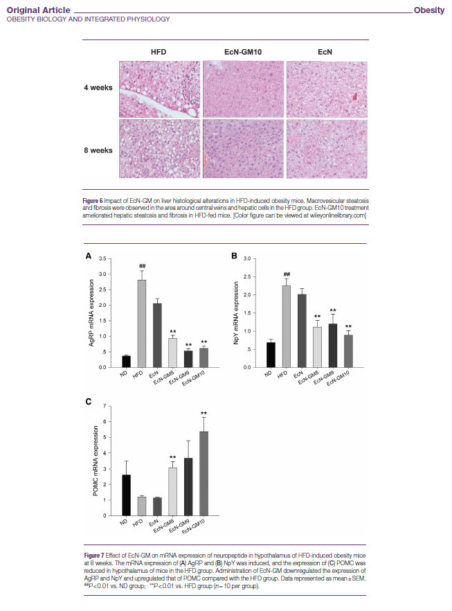益生菌是如何改善肥胖的机制,儿童肥胖吃益生菌有效果吗