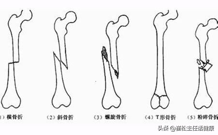疫情有腹痛症状吗,有没有疫情期间肚子疼