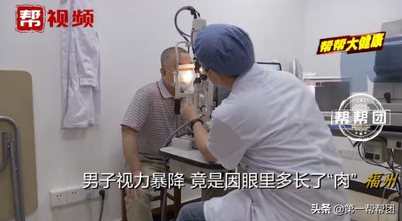 常在海边的注意了！男子视力严重下降，一查竟是眼中长了“肉”