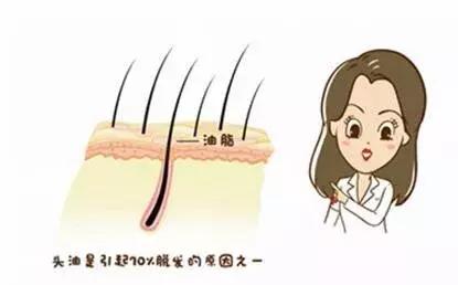 脱发患者的保健常识有什么,男性脱发的六大禁忌