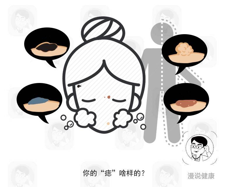 脸上长痣是癌细胞吗,皮肤上长出这3种痣千万别用手抠