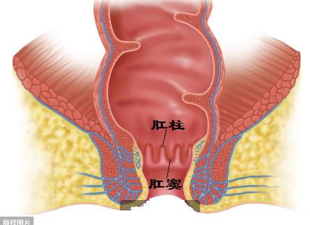 肛周脓肿有多少的几率变成肛瘘,肛周脓肿有多大的几率发展成肛瘘