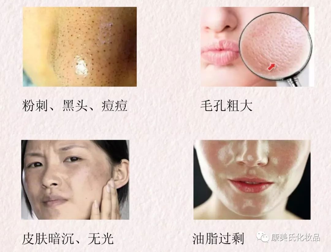 深海硅藻泥面膜,冰岛硅藻泥面膜