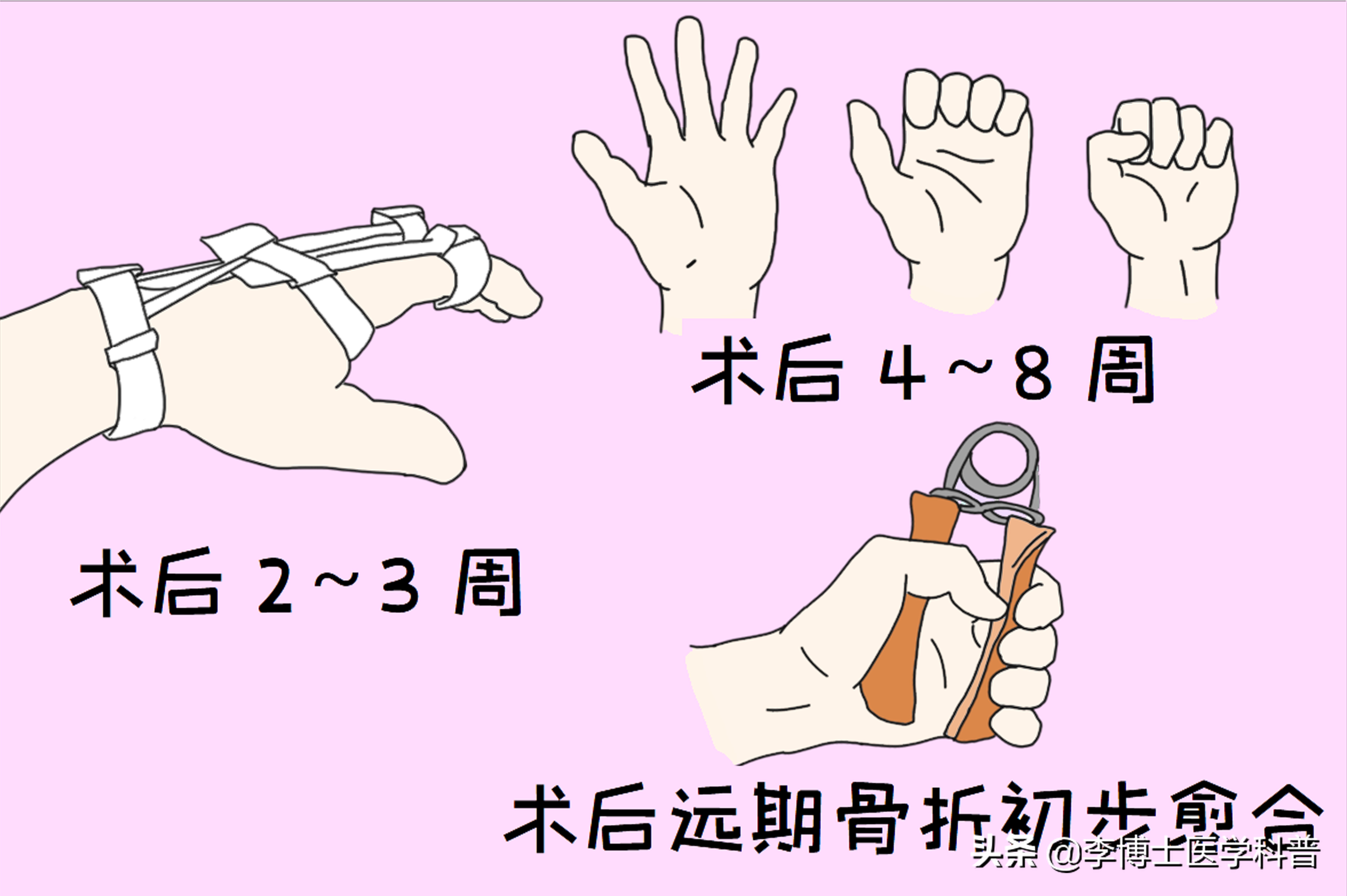 断指再植健康科普视频,断指再植技术是什么