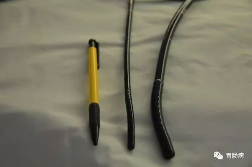 最高端的胶囊胃镜是什么技术,胶囊胃镜的基本工作原理