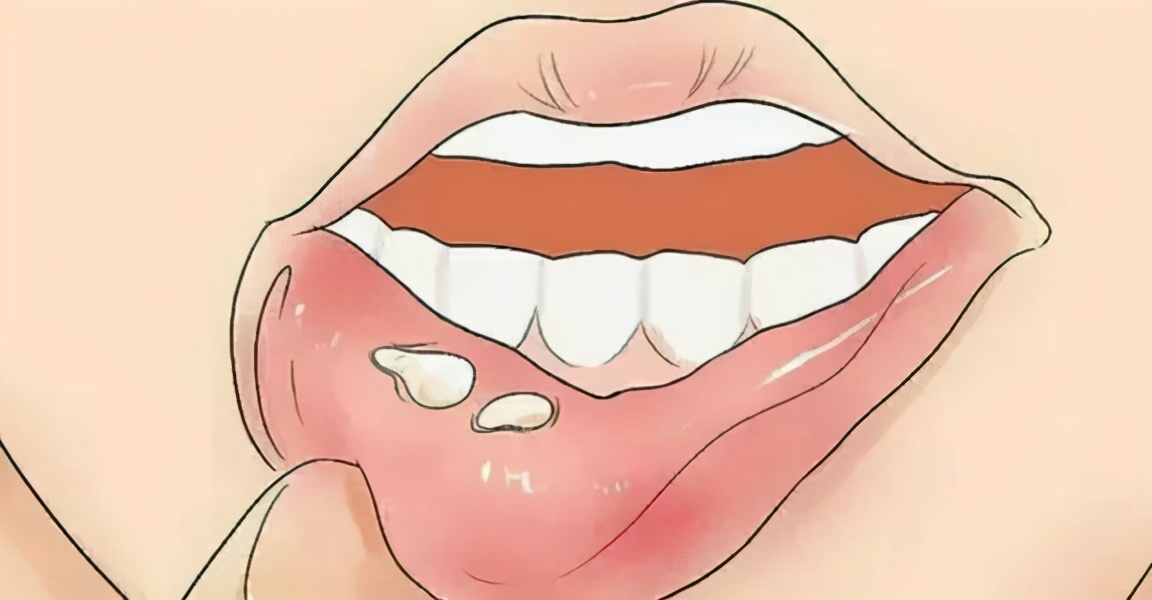 冬季咽喉肿痛、鼻塞难通……你需要身边这些实用“灭火器”！