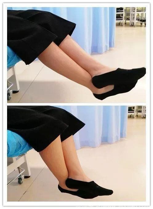 前叉术后不掰腿能不能恢复正常,前叉重建术后康复必须天天掰腿吗