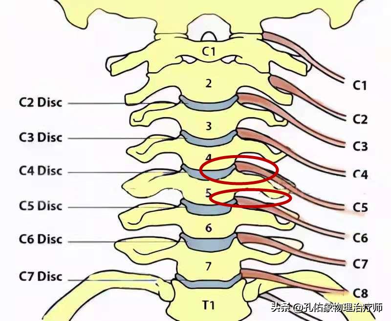 肩周炎肩膀疼是什么原因造成,肩周炎导致的肩膀疼痛怎么缓解