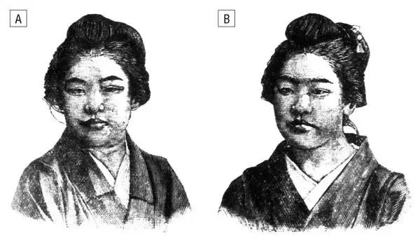 为什么东亚人是浅眼窝,东亚人为什么喜欢皮肤白