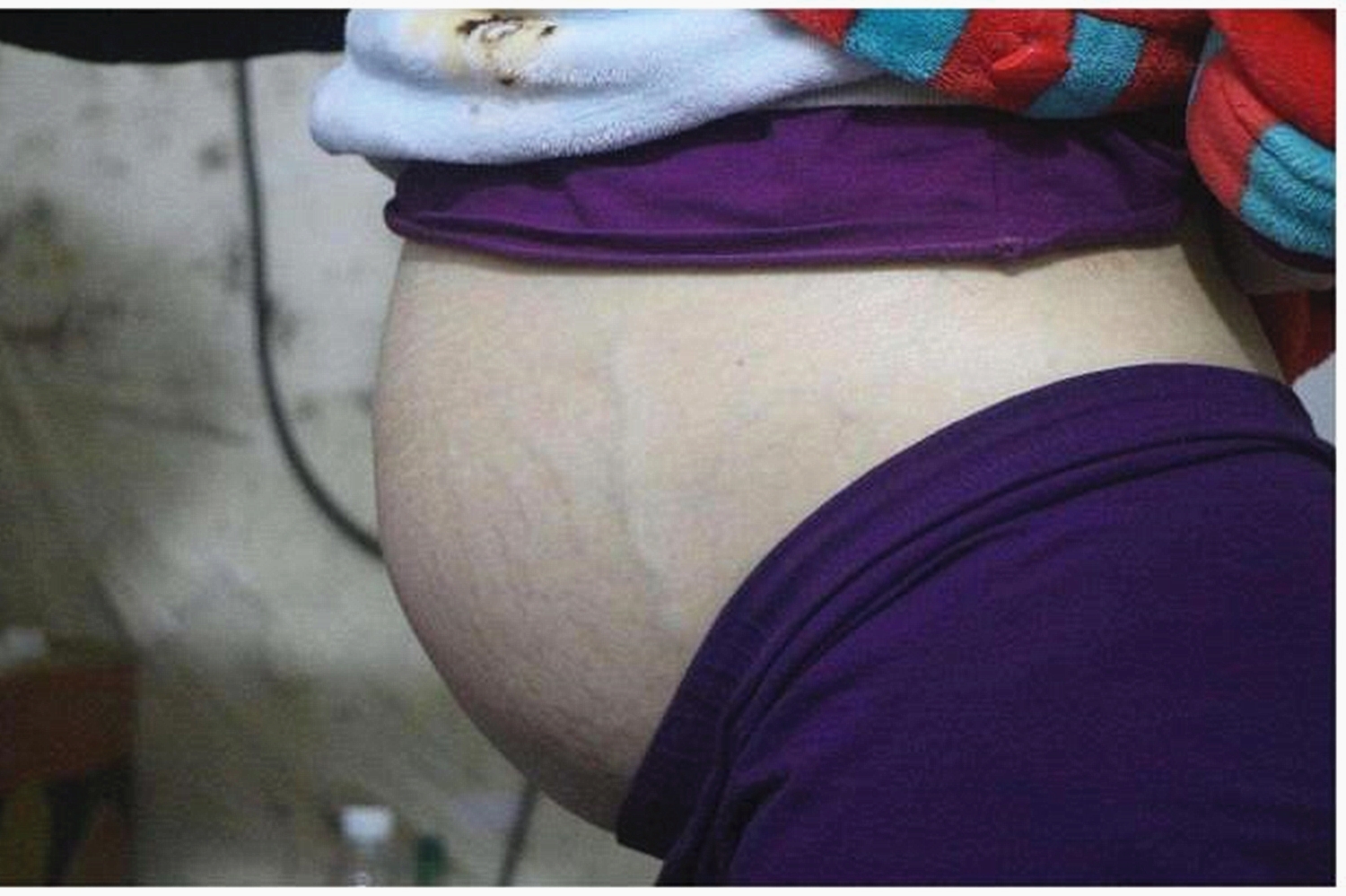 40岁孕妇妊娠43周胎儿仍不出来,去医院检查,医生痛批:糊涂