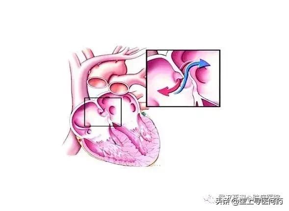 27岁女成天头晕心脏不舒服,心脏有洞引起头痛一般在什么年纪
