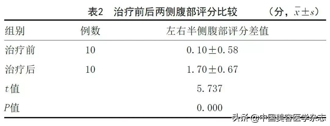 射频双极,射频综合治疗仪