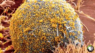 口腔有这个问题，接吻有可能被传染HPV？