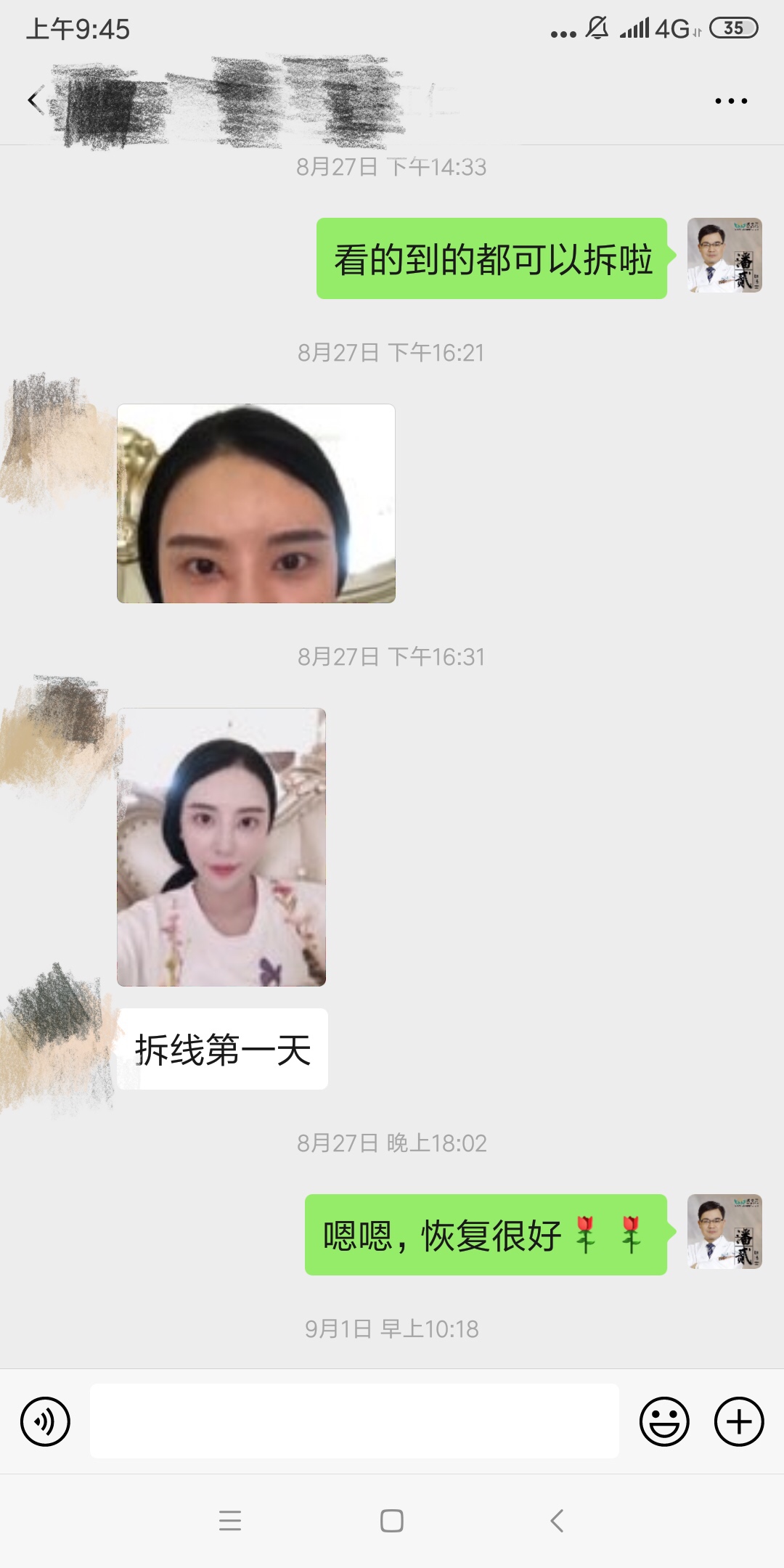 开内眼角会留疤的照片,开内眼角的疤痕变白色了怎么办