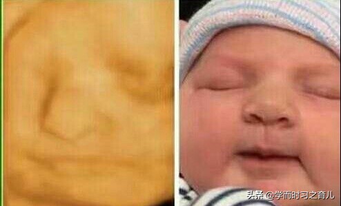 孕妇四维图片上为什么会有阴影,宝宝四维照为什么鼻子嘴巴都很大