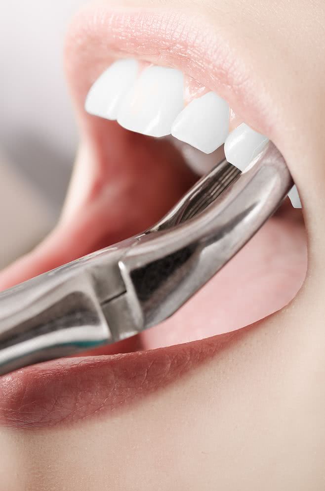 70岁老人拔牙注意事项与禁忌症,拔牙过程的操作步骤及注意事项