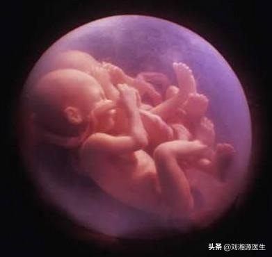 【免疫相关不良妊娠答疑解惑30】——胎膜早破