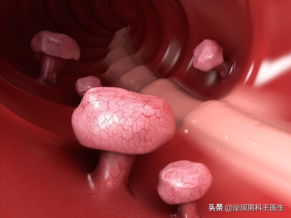 难以启齿的病很常见,难以启齿的病是什么病