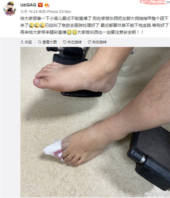 Uzi突发意外！脚部受伤坐上轮椅，女友晒枣子受伤照吓坏了粉丝