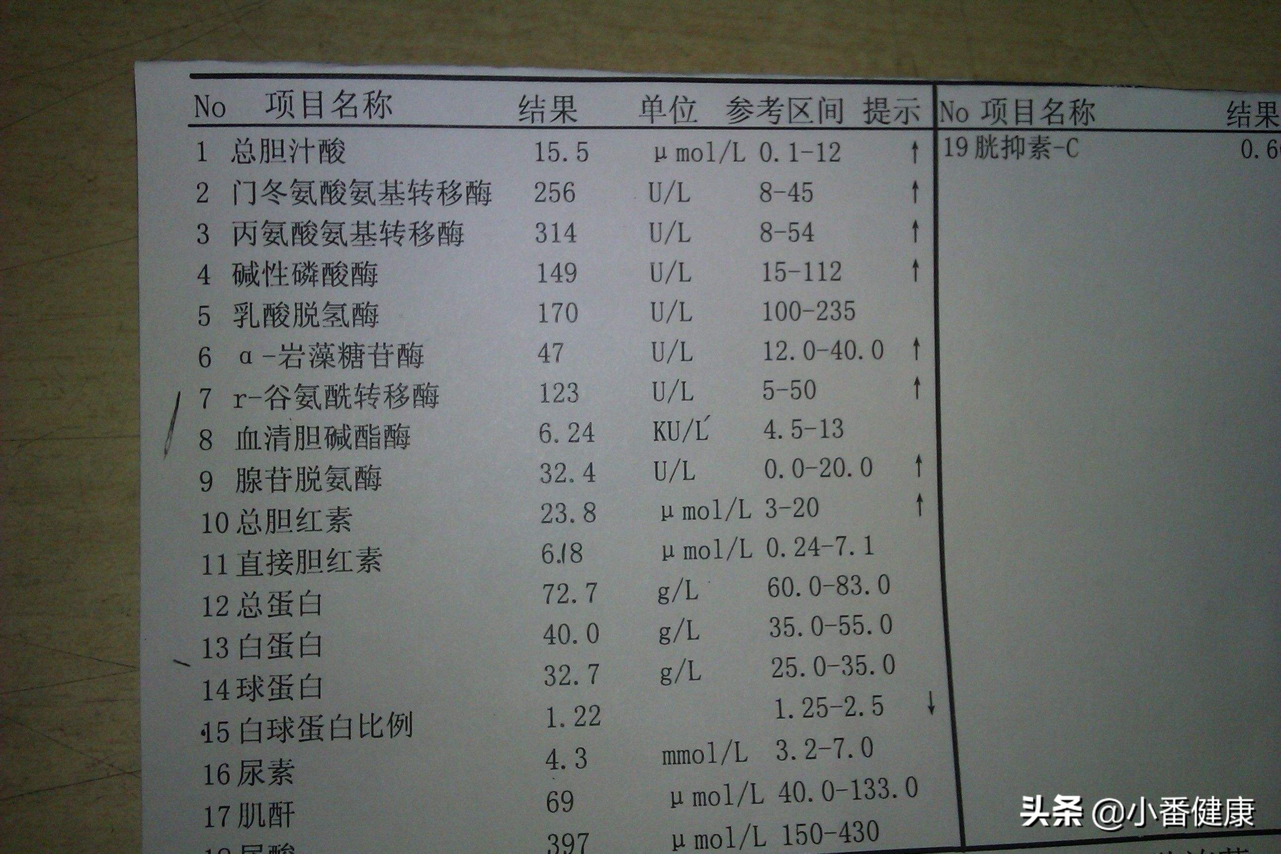 乙肝两对半145阳性，HBV-DNA呈现少量复制，这种可以放松吗？