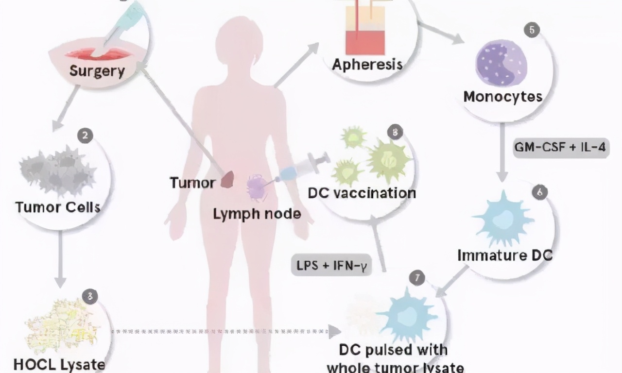 癌症疫苗最新研制进展,唯一一个预防癌症的疫苗