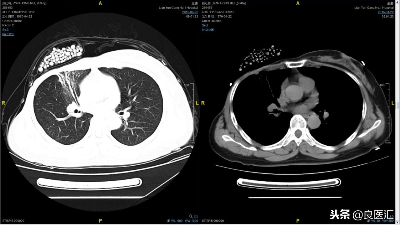 美图秀秀成功案例,美图秀秀实战案例