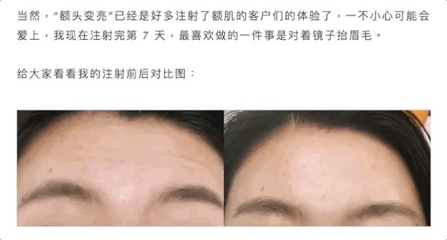 打完瘦脸针和祛皱针注意事项,经常打瘦脸针跟去皱针会怎么样