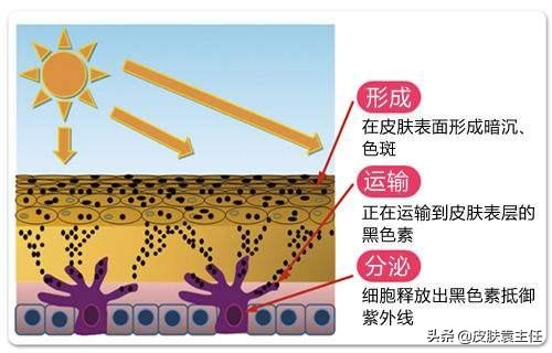 遮瑕遮不住雀斑怎么办,什么样的遮瑕可以遮掉雀斑