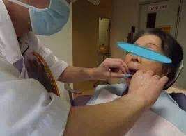 咬合重建详细步骤,如何制作咬合模型