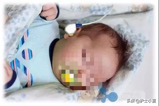 新生儿听力障碍是什么原因导致的,新生儿听力损害高危儿