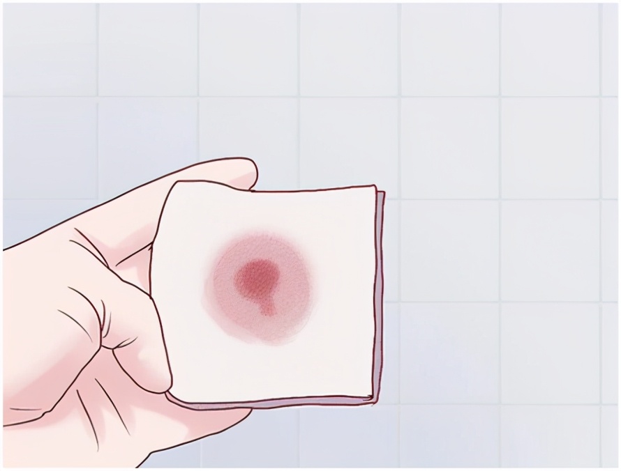 产后痔疮脱出一大坨很痛都坐不了,为什么产后痔疮更严重