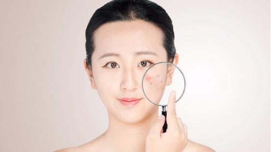 水乳里致敏致痘成分有哪些,致痘的化妆品含量是什么