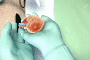 医生手术后最想做什么,医生做完手术以后会怎样