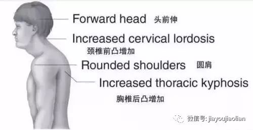 三步帮你解决圆肩问题