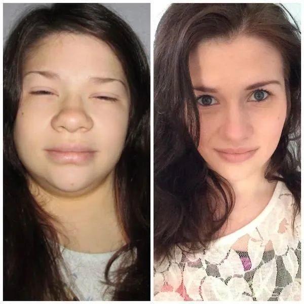 昨天脸瘦今天脸胖,昨天脸是白的今天早上起来就黑了