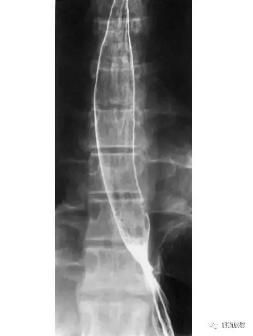 「收藏」11种消化道造影解剖图谱