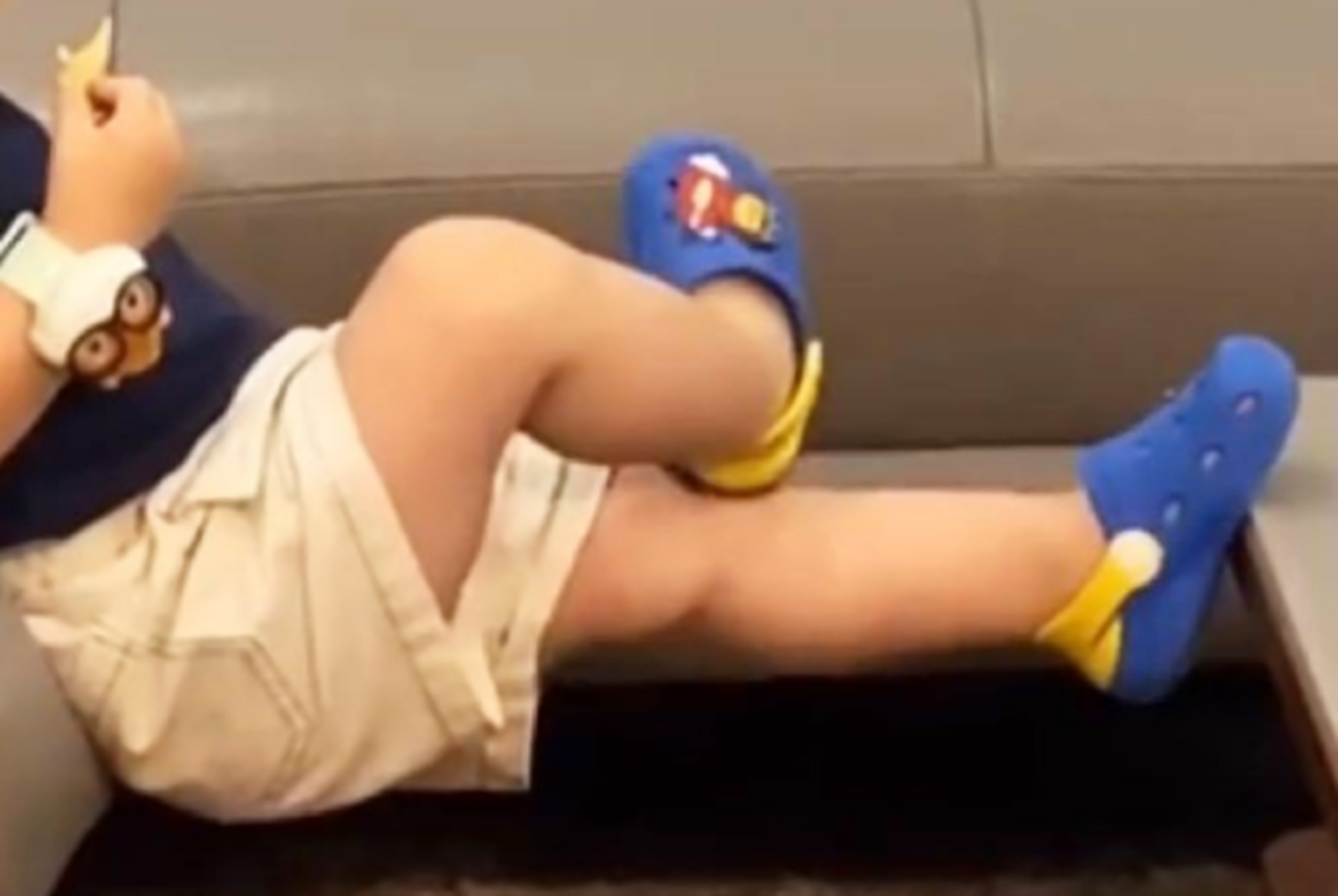 什么原因会导致孩子罗圈腿,孩子有点罗圈腿怎么矫正