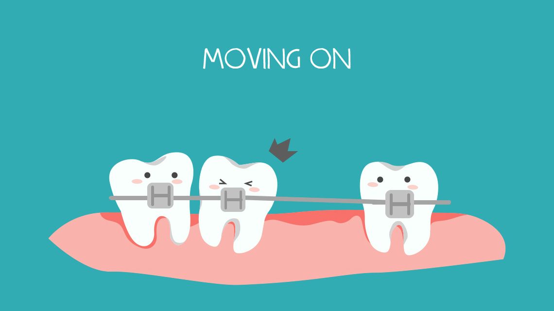 下牙不整齐如何自动矫正不戴牙套,半口牙矫正下排牙缝大