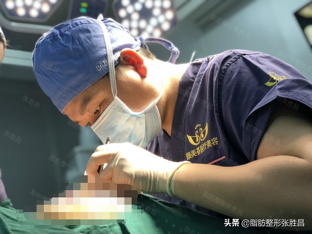 自体脂肪填充变丑了怎么办,自体脂肪填充面部会造成面部变形