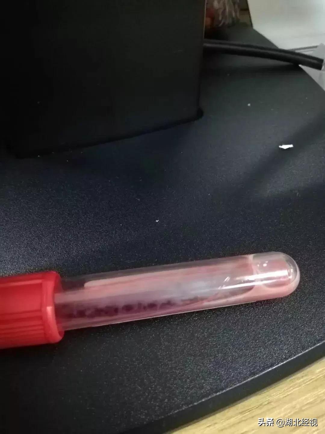 医生惊了!怀胎32周孕妇突发腹疼,抽血检查发现有半管都是油脂……