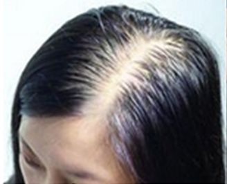 这么吃，最容易掉头发....