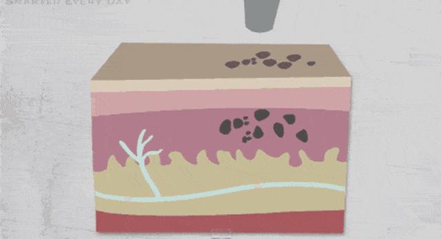 皮秒祛斑效果怎么样值得做吗,皮秒祛斑祛痣怎么样