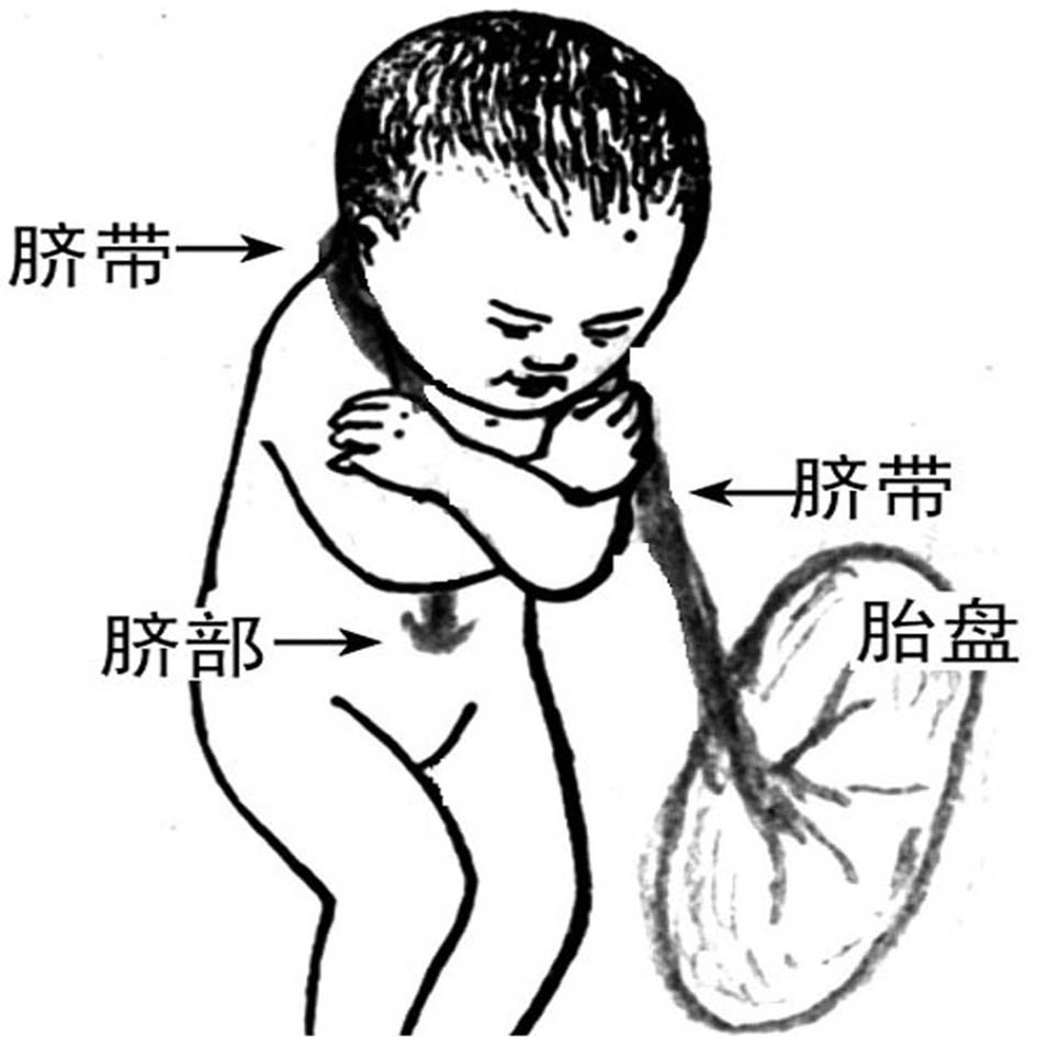 脐带过长超声诊断,脐带过长或过短能检查出来吗