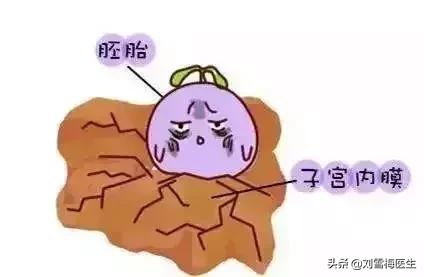 黄体酮不足导致的胎停有什么症状,怀孕14周胎停有什么症状或征兆吗