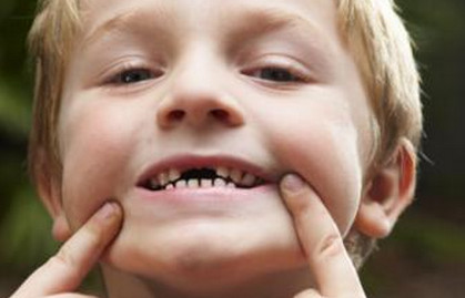 乳牙拔出恒牙不长在原来的位置,孩子的乳牙迟迟不掉怎么回事