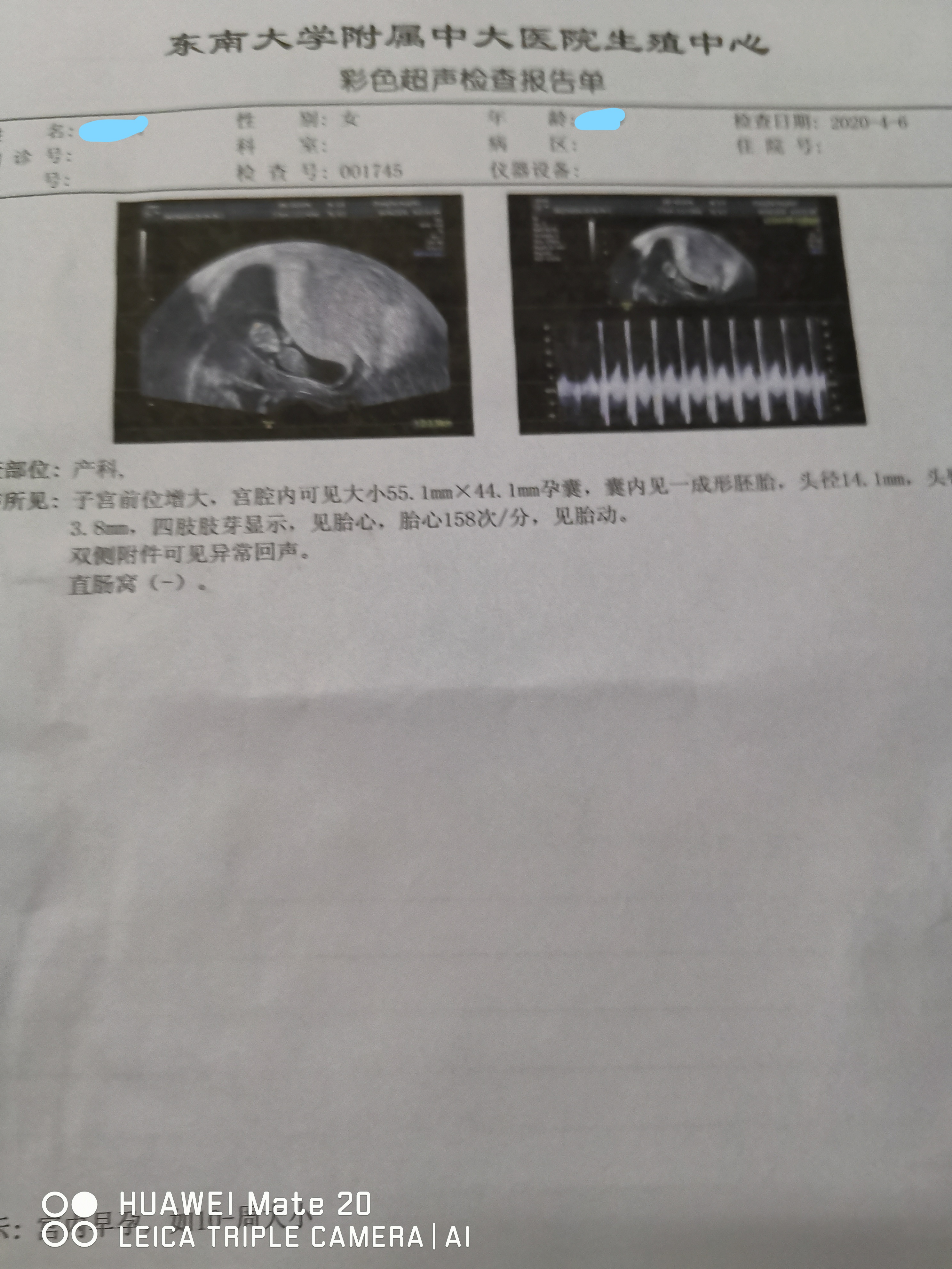 排卵障碍性不孕症的诊疗策略,排卵障碍不孕中最常见的原因是