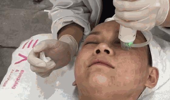 激光美容有哪些必要做,激光整形真相