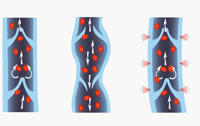 夜光魔力裤,魔力燃烧裤